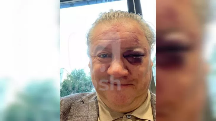 Андрей Канчельскис