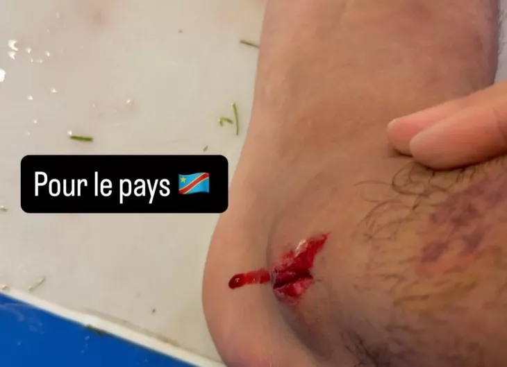 ФК Спартак Москва, Сборная ДР Конго